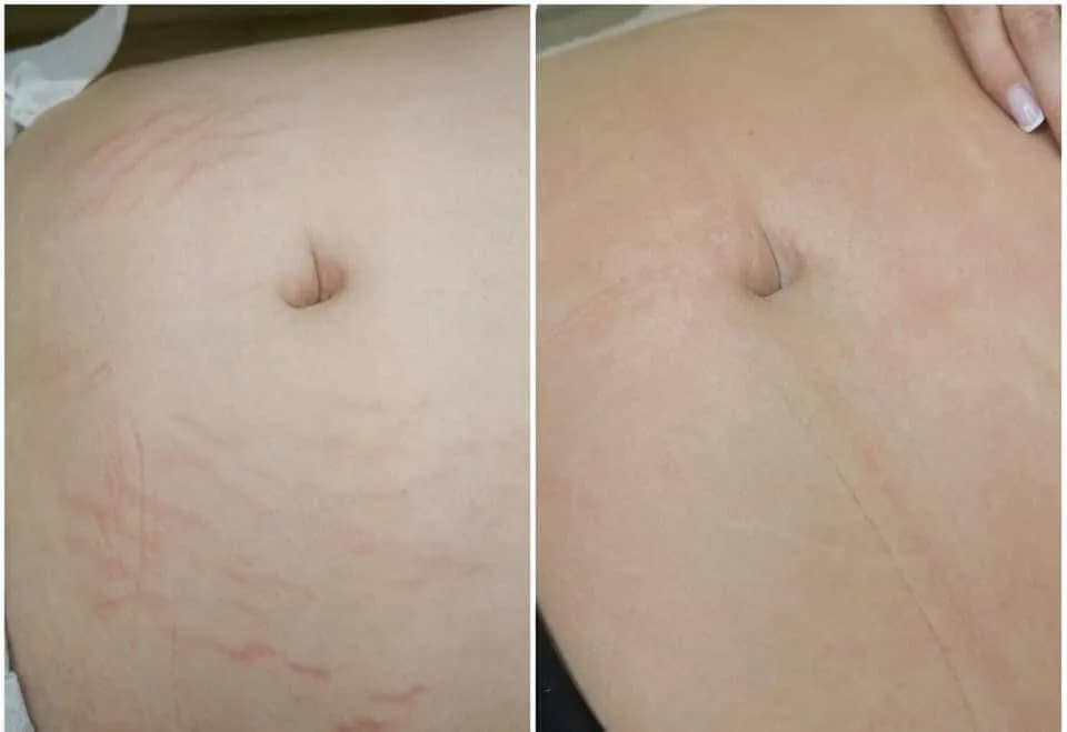 Gdzie kupić deep phyto peeling i uniknąć nieefektywnych produktów